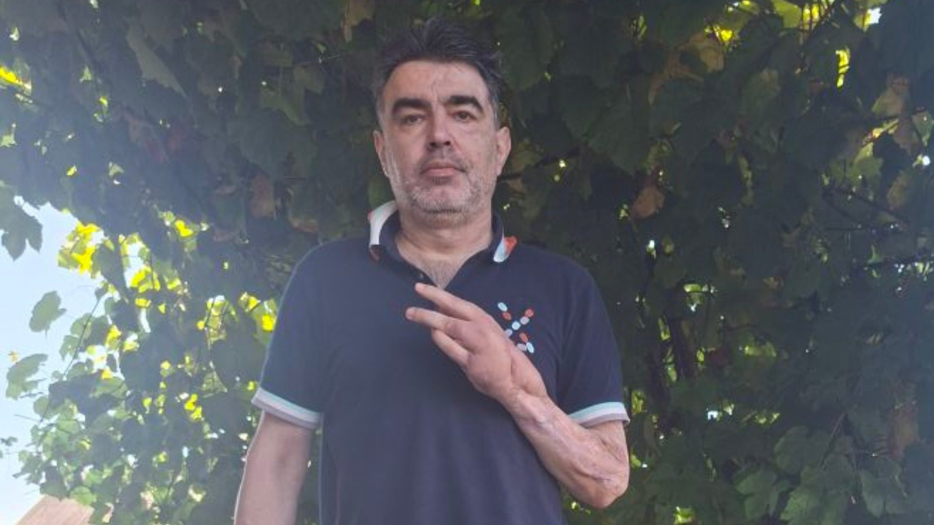 Чому ветерани в шортах? Військовий відповів на безтактне зауваження перехожої
